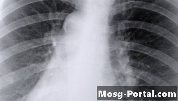 Chức năng của Alveoli trong phổi là gì?