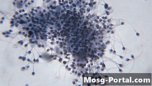 Kirpikler ve Flagella'yı Oluşturan Bazal Organlar Ne Kaynaklıdır?